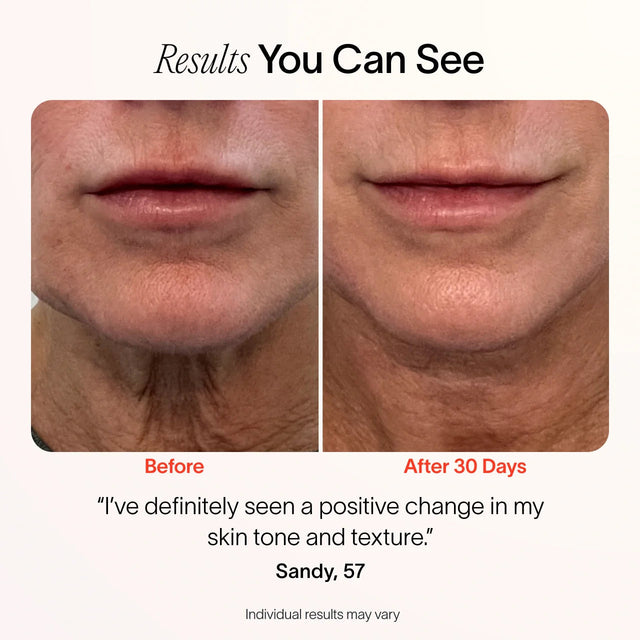 4-In-1 Radiant Renewal Skincare Wand with Red Light Therapy