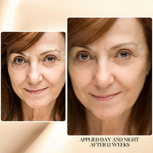 Anti-Aging Bundle, Large