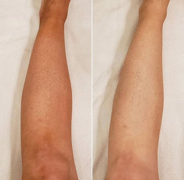 BEETOFF SELF-TANNING ERASER