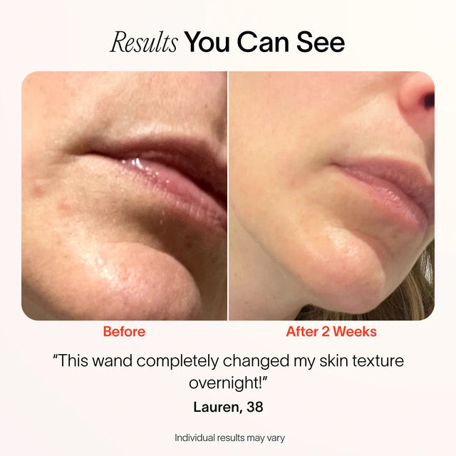 4-In-1 Radiant Renewal Skincare Wand with Red Light Therapy