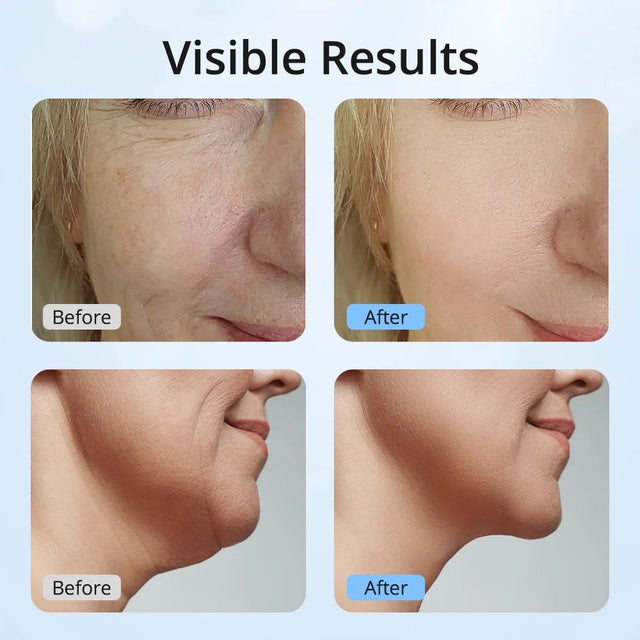 7 Color LED Neck Tightening Facial Device,Red Light Therapy for Face,Neck Lifting Device Face Massager for Face Lift, Facial Massager, anti Aging, 3 in 1 Portable Skin Care Tools, White