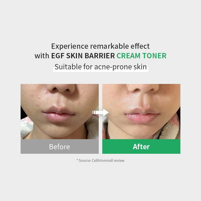 Z+PIDERM ECF Skin Barrier Cream Toner