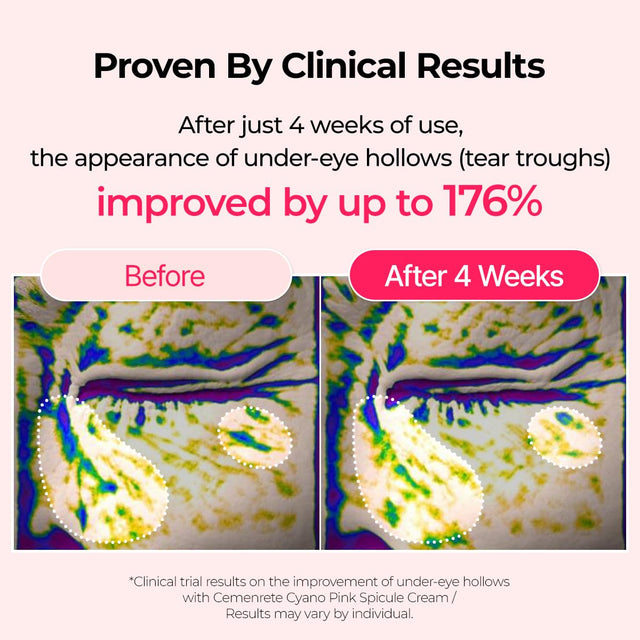 Dr. Melaxin Cemenrete Cyano Pink Spicule Cream