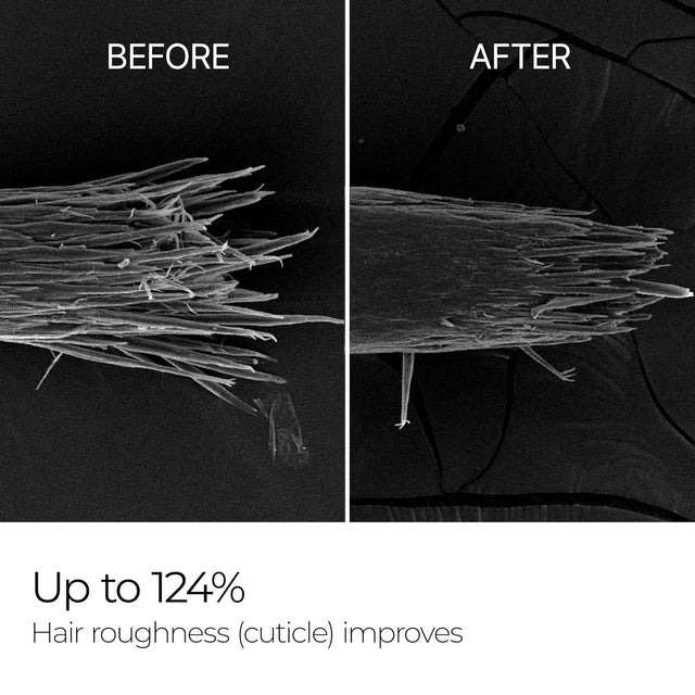 Dr. Melaxin Bondex Clinic II Protein Binding Remodeling Clinic Treatment