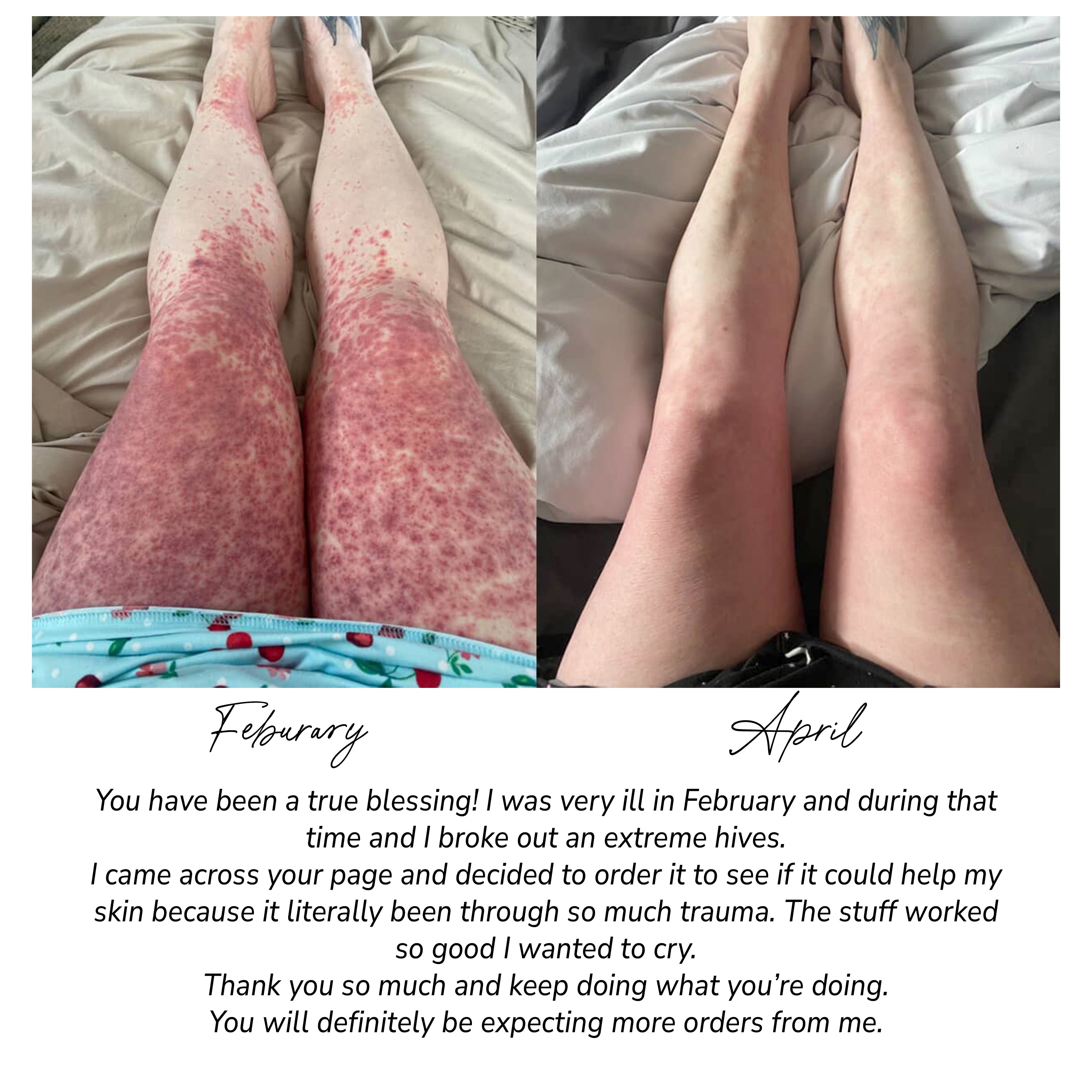 Fragrance Free Tallow + Honey Cream for Sensitive Skin