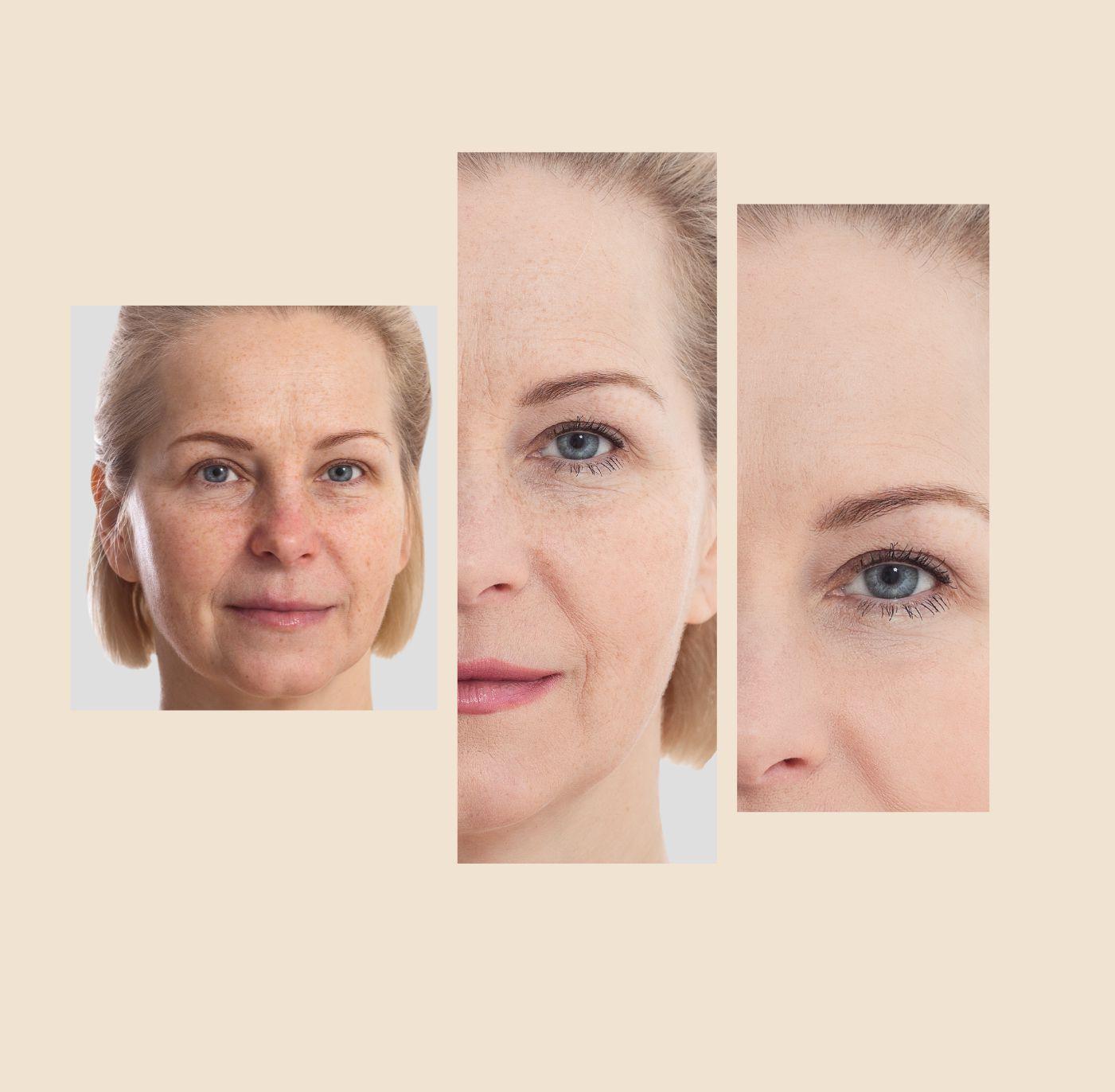 The Eraser Spot Cream | Dark Spot Remover