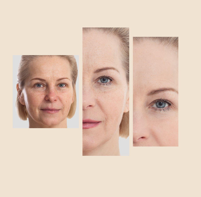 The Eraser Spot Cream | Dark Spot Remover