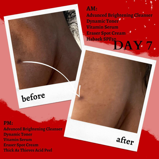 The Eraser Spot Cream | Dark Spot Remover